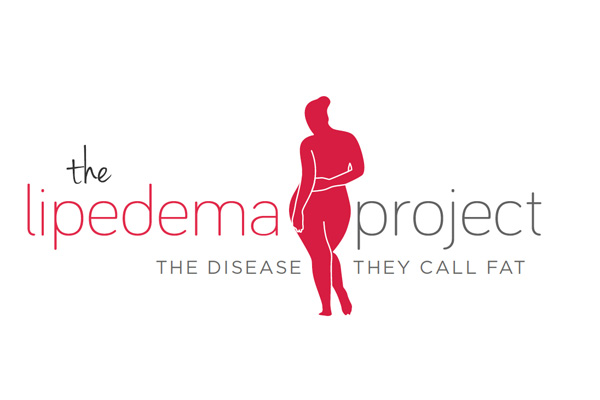 Lipedema: What We Know and What We Need to Know