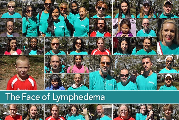 The Face of Lymphedema Challenge | Lymphatic Education & Research Network