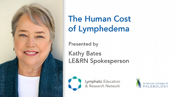 The Human Cost of Lymphedema thumbnail Photo