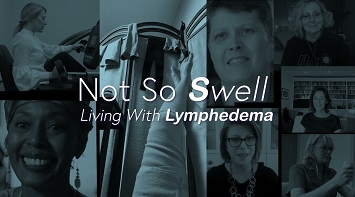 Not So Swell, Living with Lymphedema thumbnail Photo