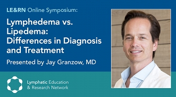 Lymphedema vs. Lipedema: Differences in Diagnosis and Treatment thumbnail Photo