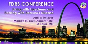 Living with Lipedema and Dealing with Dercum’s