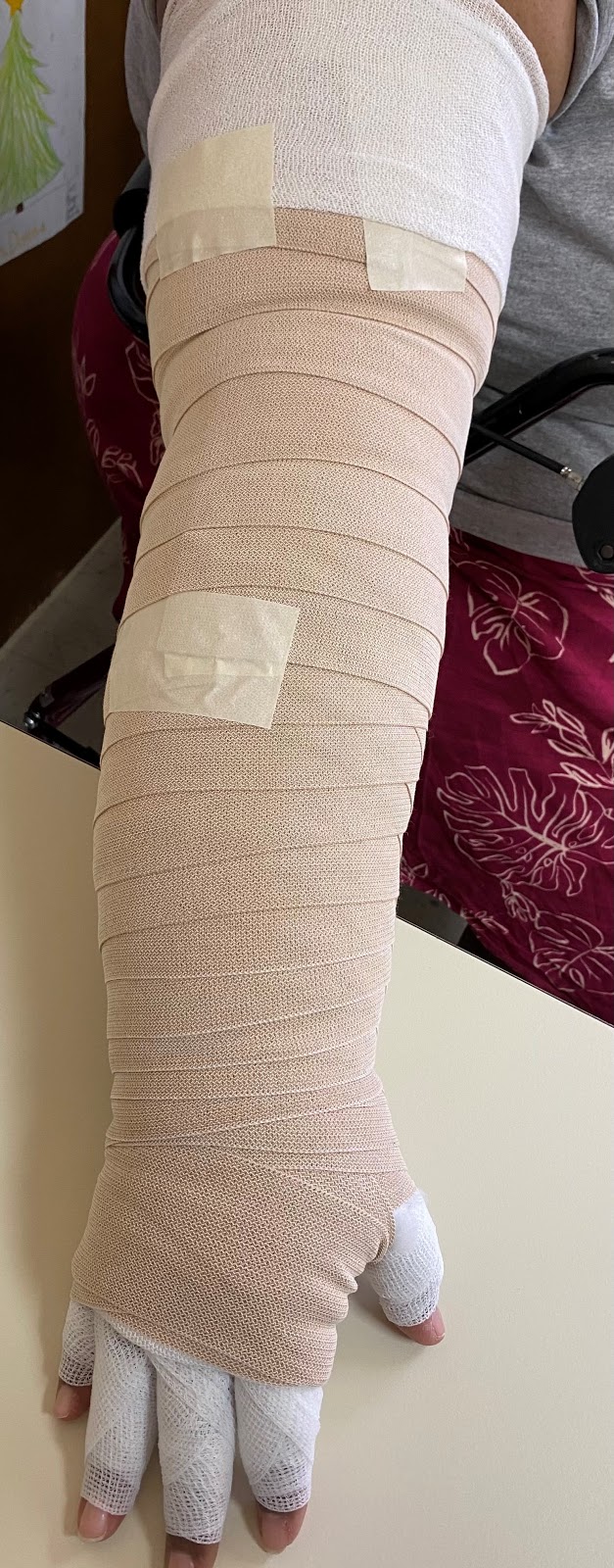 Orthotist Bandaging and Compression Garments Course - Lymph Africa